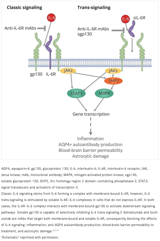 FIGURE. IL-6 Signaling and Potential Therapeutic Inhibition
