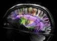 New Imaging Spots Inflammation in Brain Disorders