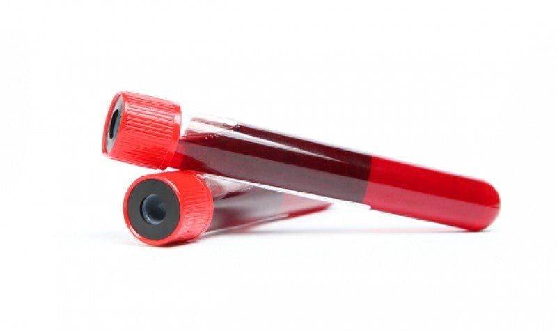 blood test vials