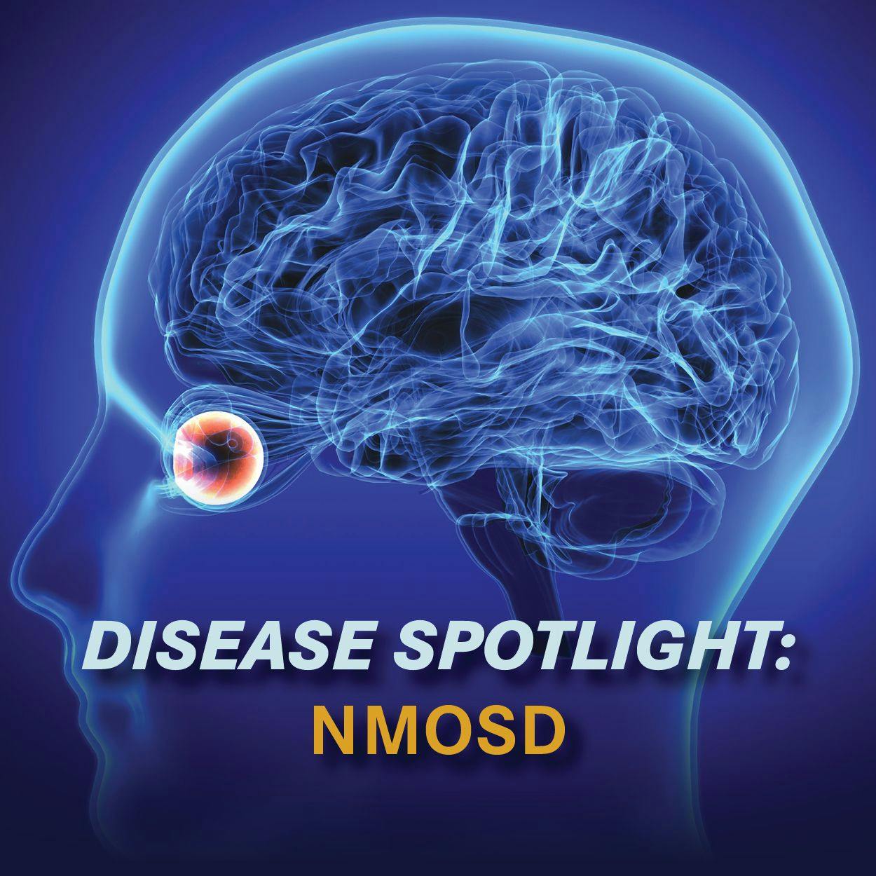 Disease Spotlight: NMOSD