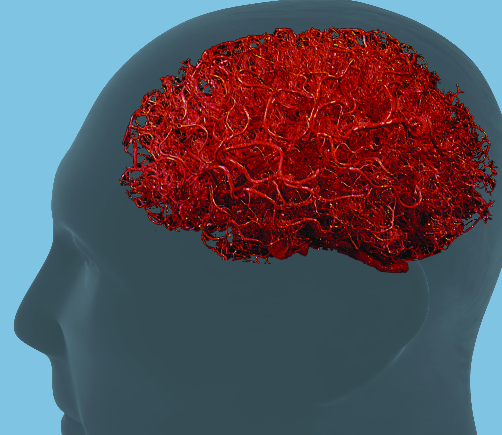 A New Tool to Assess Brain Vascular Health