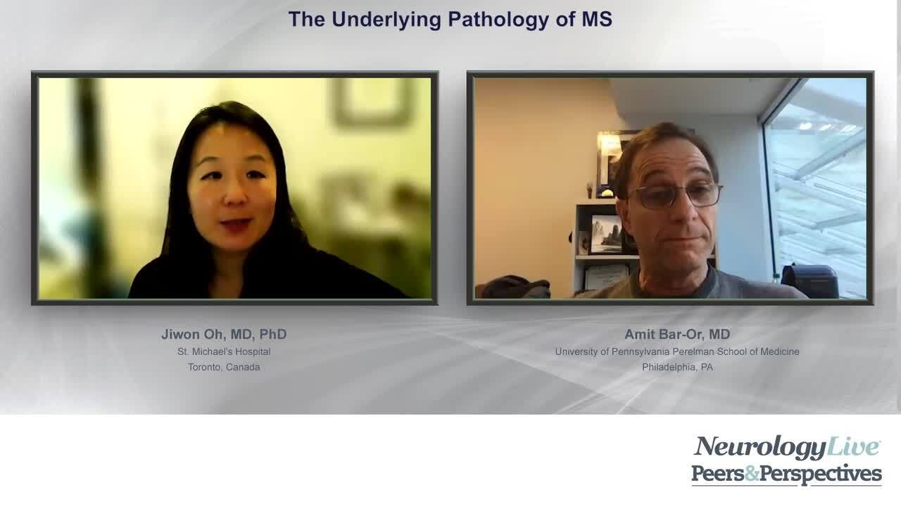 The Underlying Pathology of MS