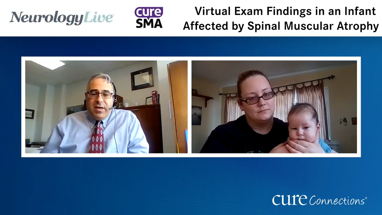 Virtual Exam Findings in an Infant Affected by Spinal Muscular Atrophy 
